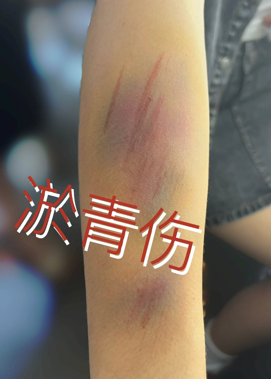 日常分享 | 淤青伤 伤效妆之淤青伤9599 	 99步骤: 1,黄色眼影