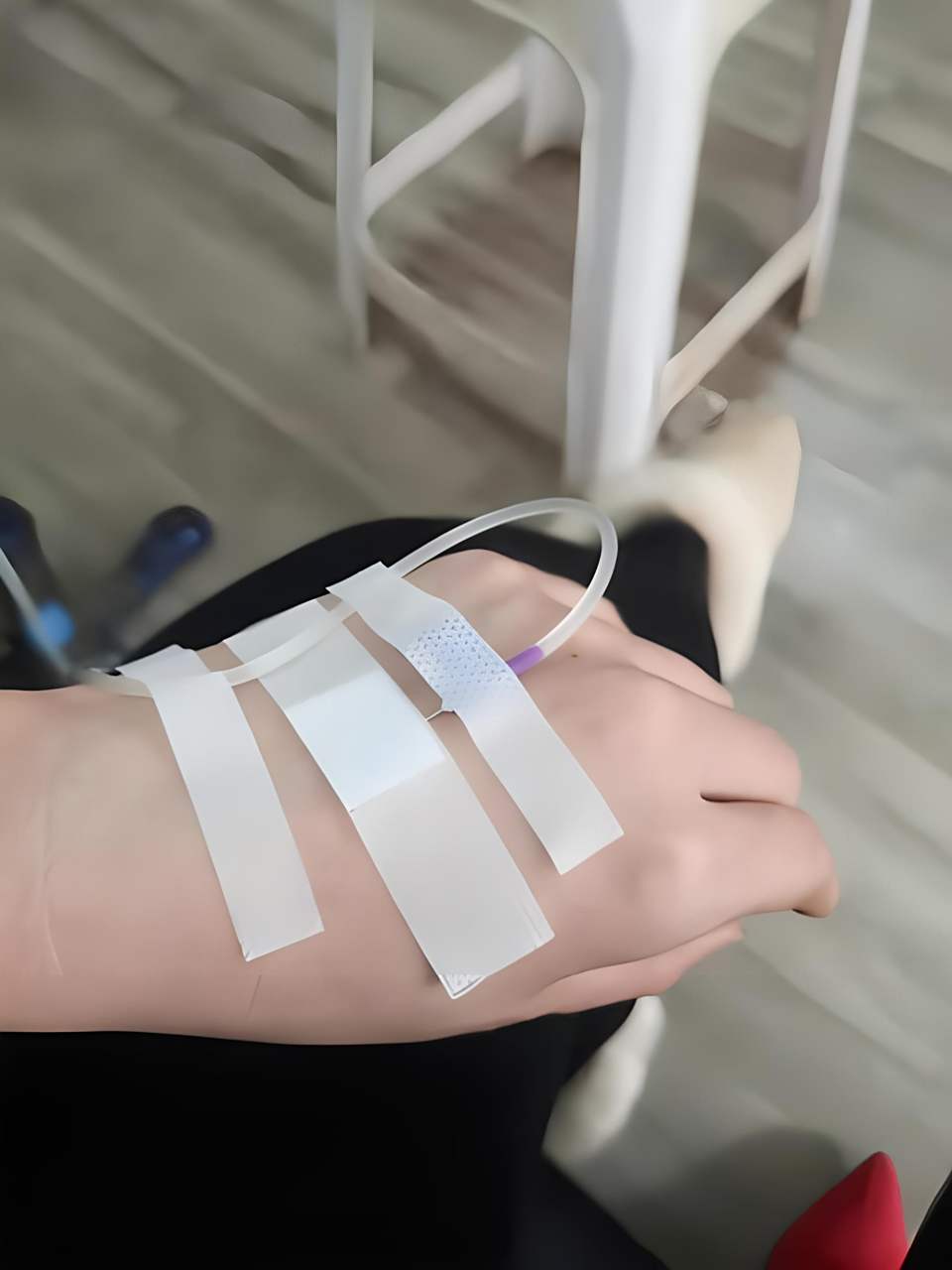 今天给大家分享一些真实的打吊针图片,希望大家都能健康平安!94