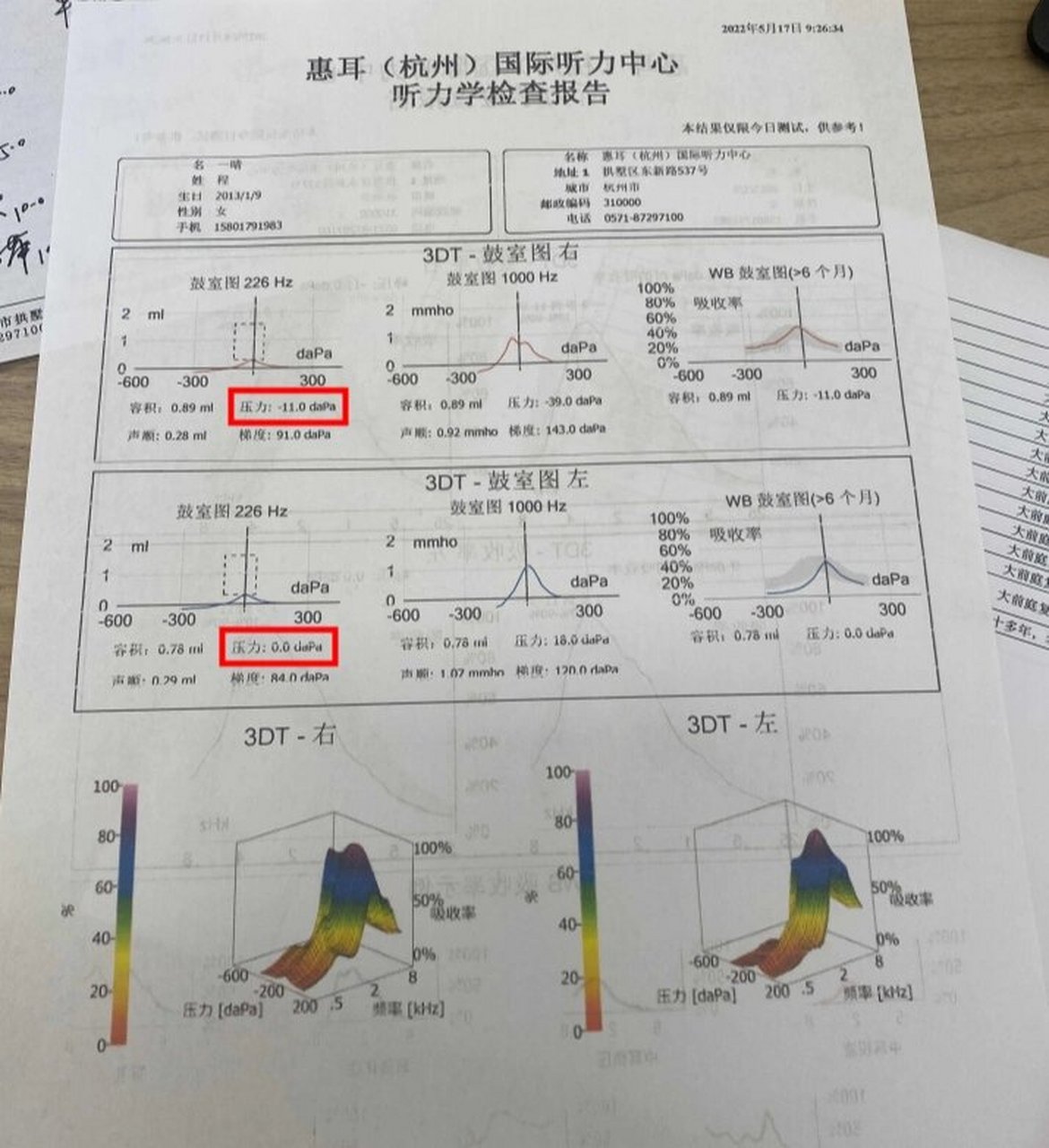一分钟看懂声阻抗-----  正常人鼓膜内(中耳)的压力应该与外界相等的
