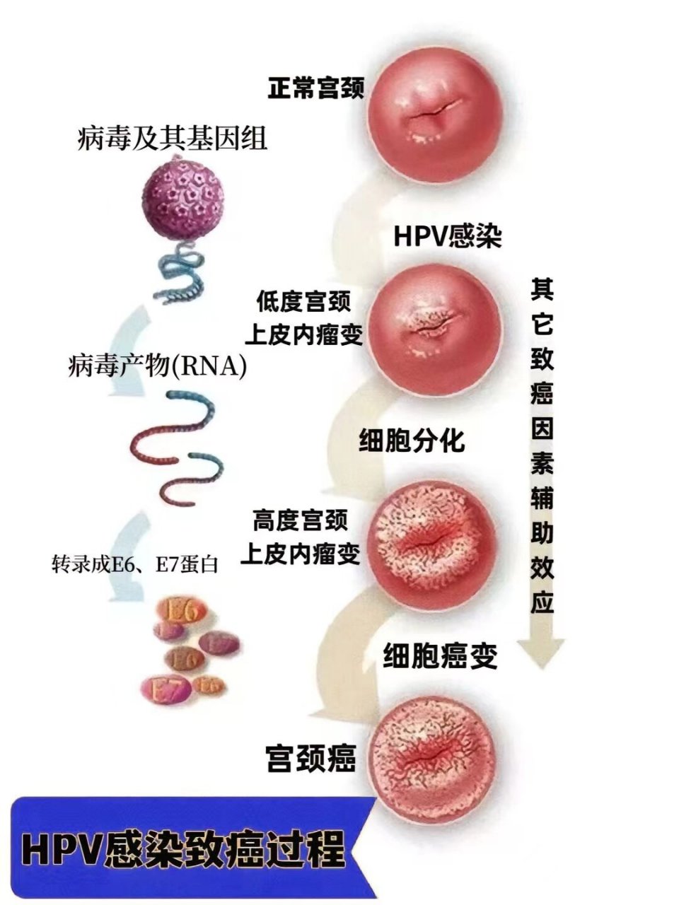 人乳头瘤病毒61型图片