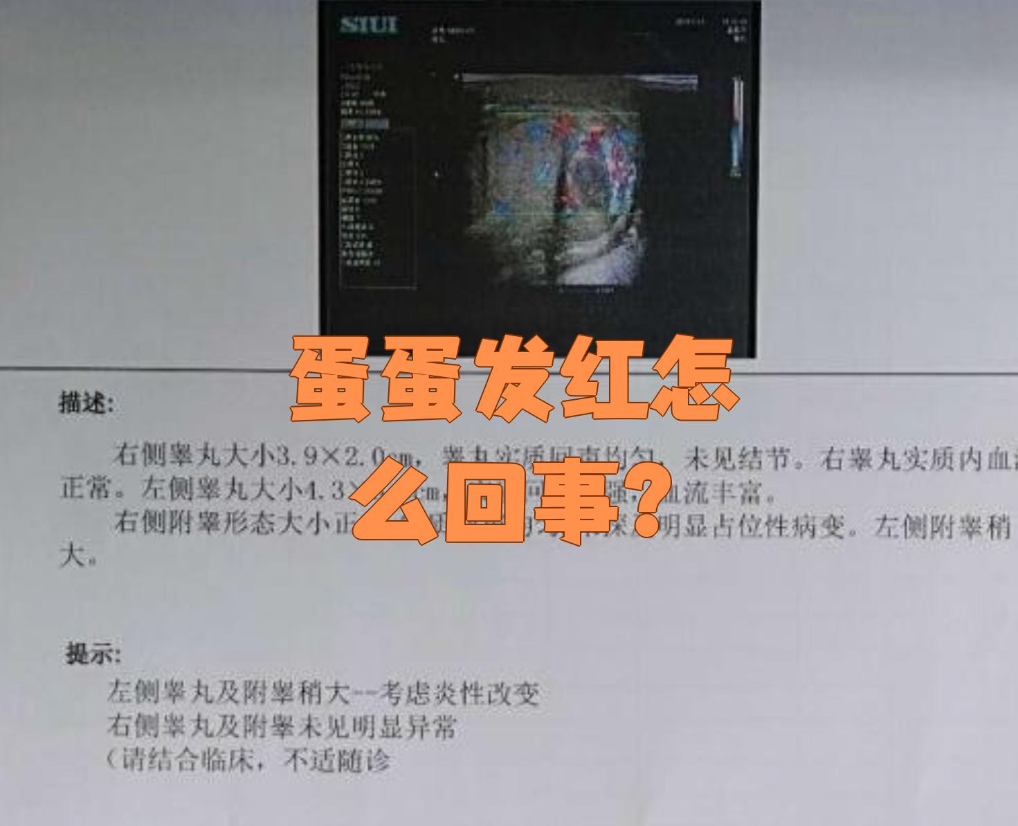 这种情况最常见的原因是炎症,比如睾丸炎,附睾炎,也可能是阴囊皮肤