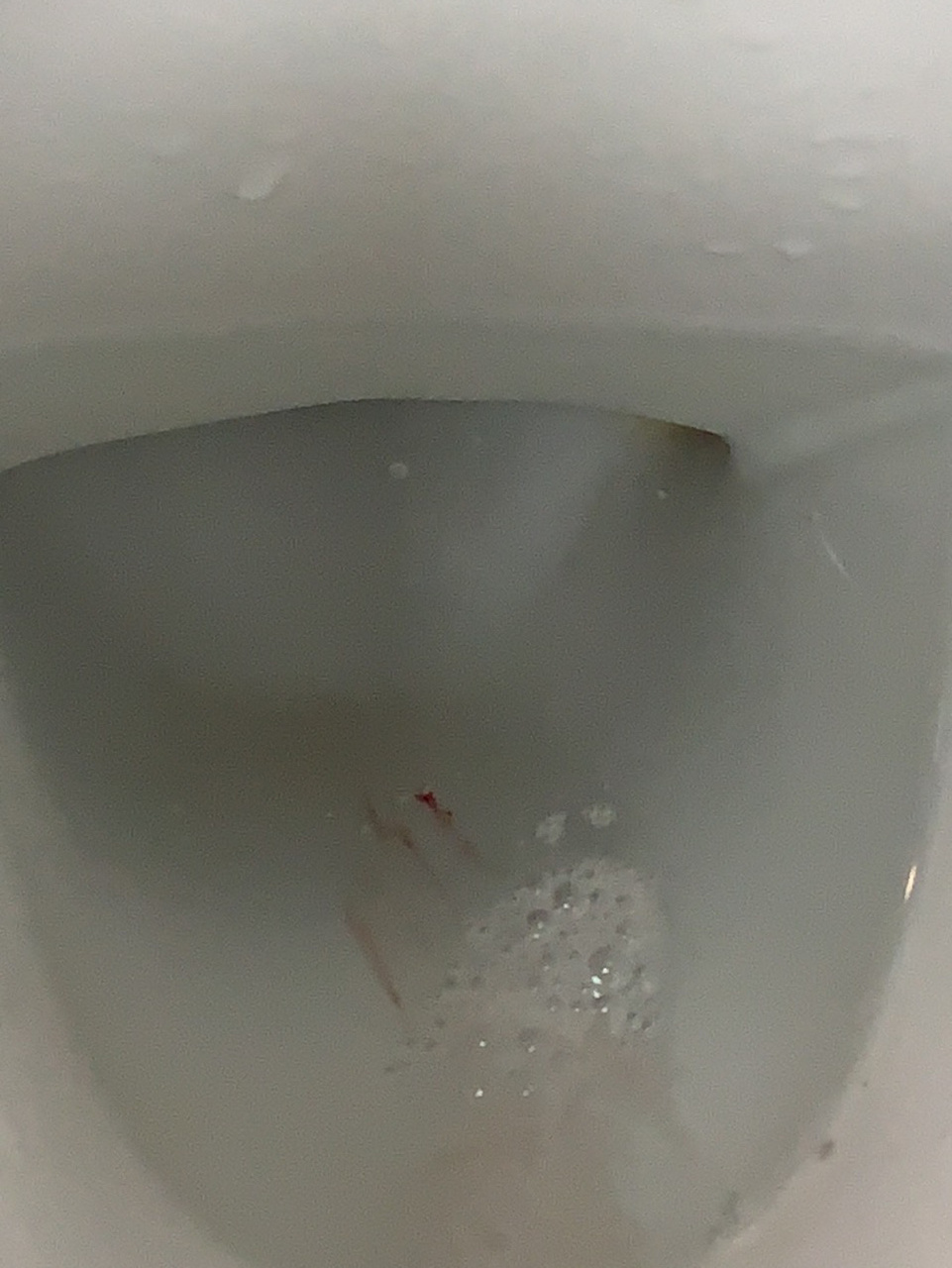 吐到喉咙出血了怎么办 现在十周774,已经连续几天,吐到喉咙出血,不