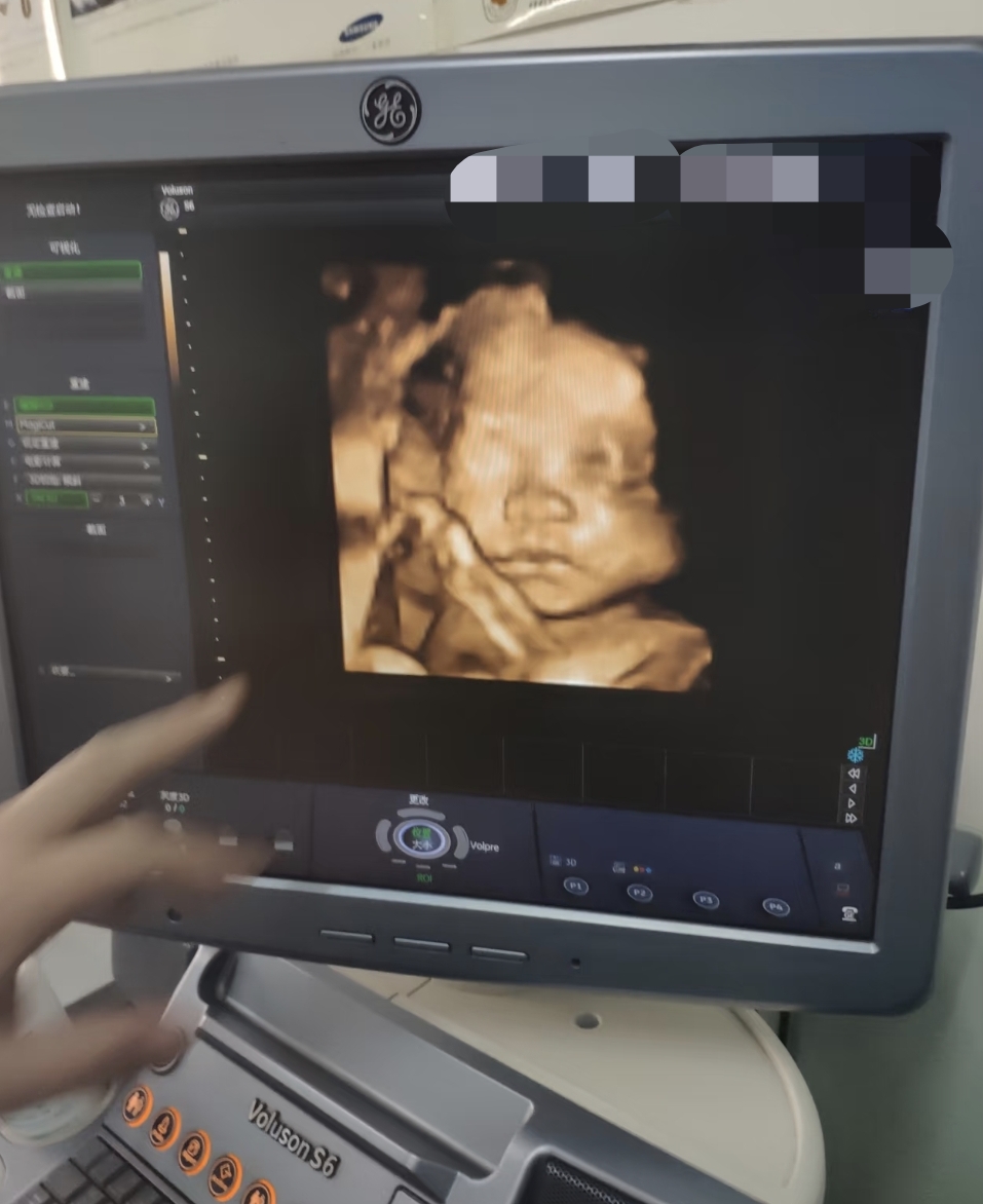 怀孕5-6个月是做四维彩超最好的时候