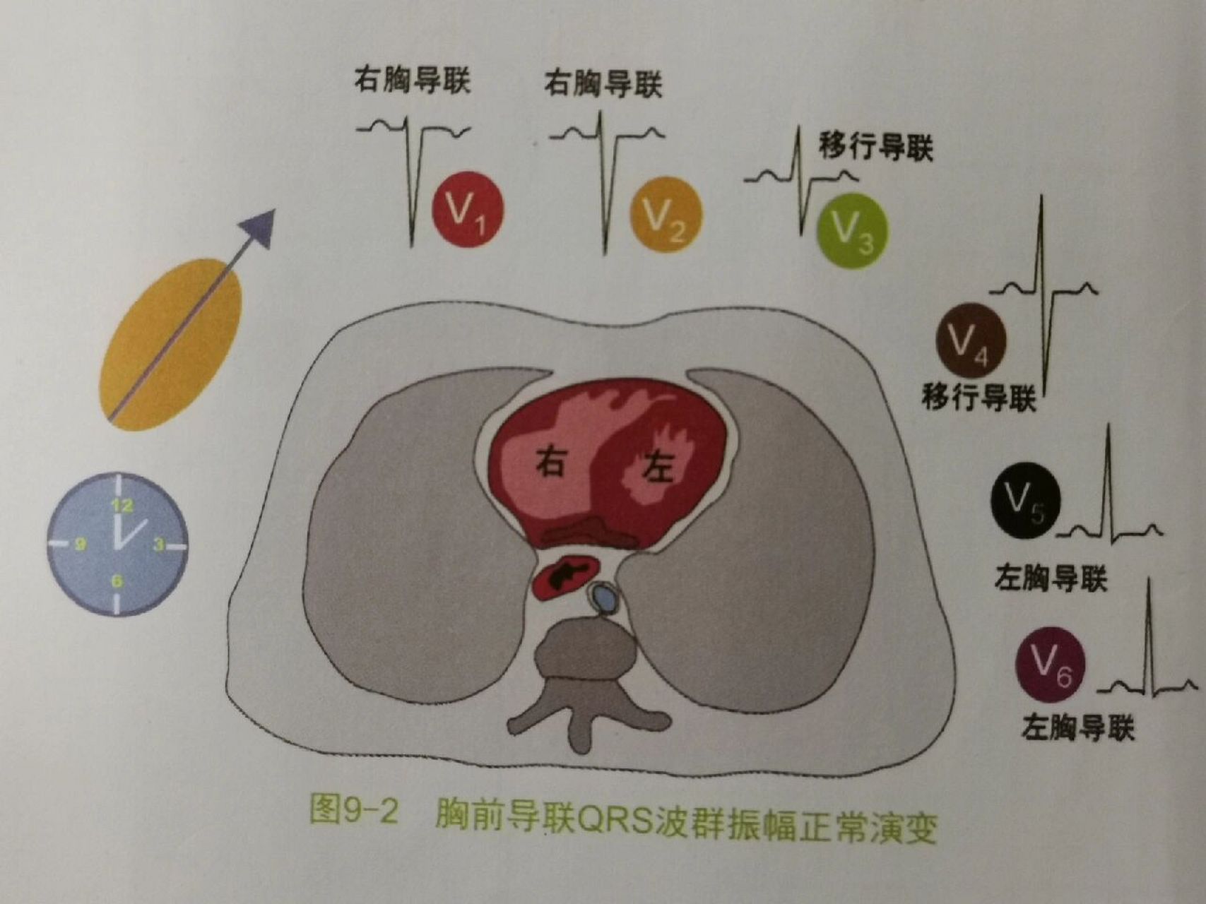 心电图分析2——钟向转位 1.什么是钟向转位?