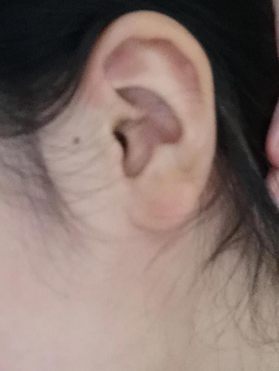 右耳朵这里有个痣有什么寓意吗 很神奇,小时候没有发现这里居然有痣