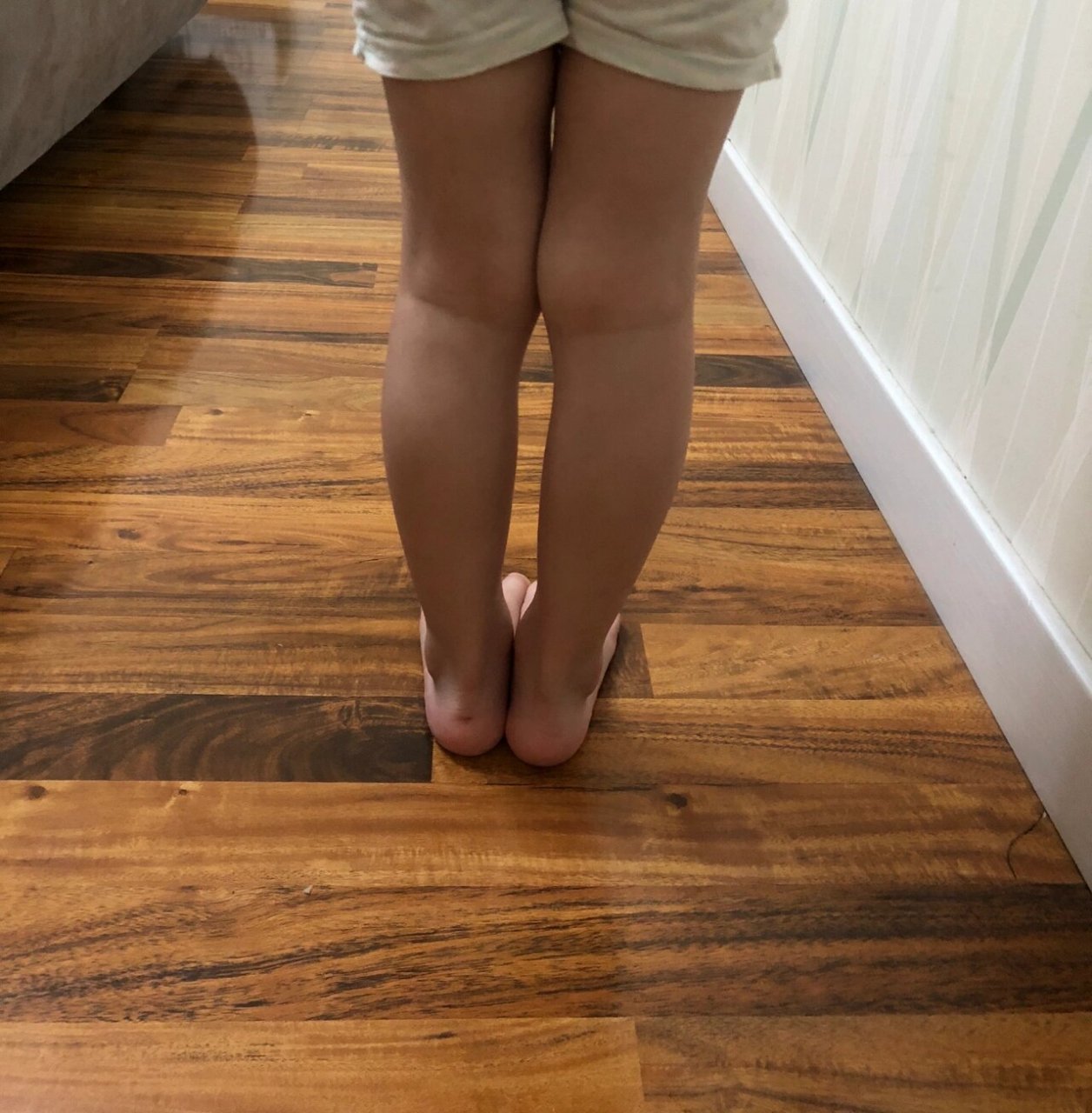 3岁半宝宝腿型 大家帮我看看这个腿有问题没,小腿闭不拢,脚后跟感觉有