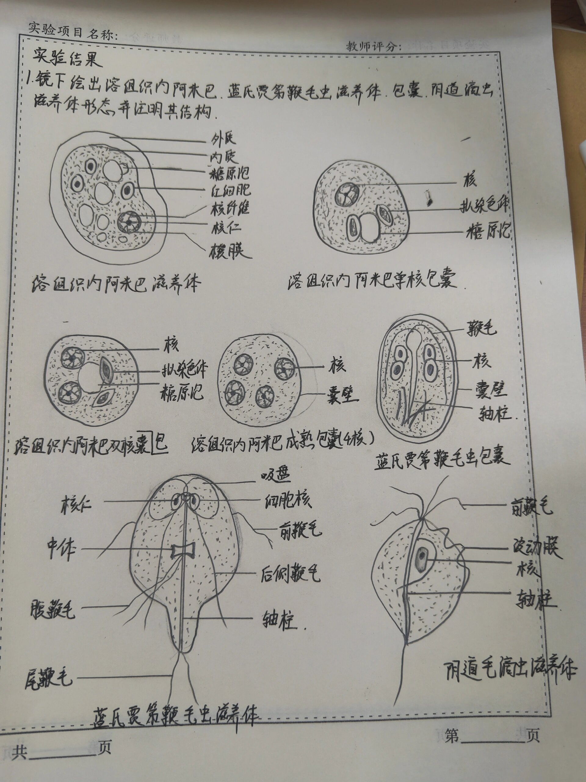 微生物与寄生虫实验报告 溶组织内阿米巴滋养体,单核,双核,成熟包囊