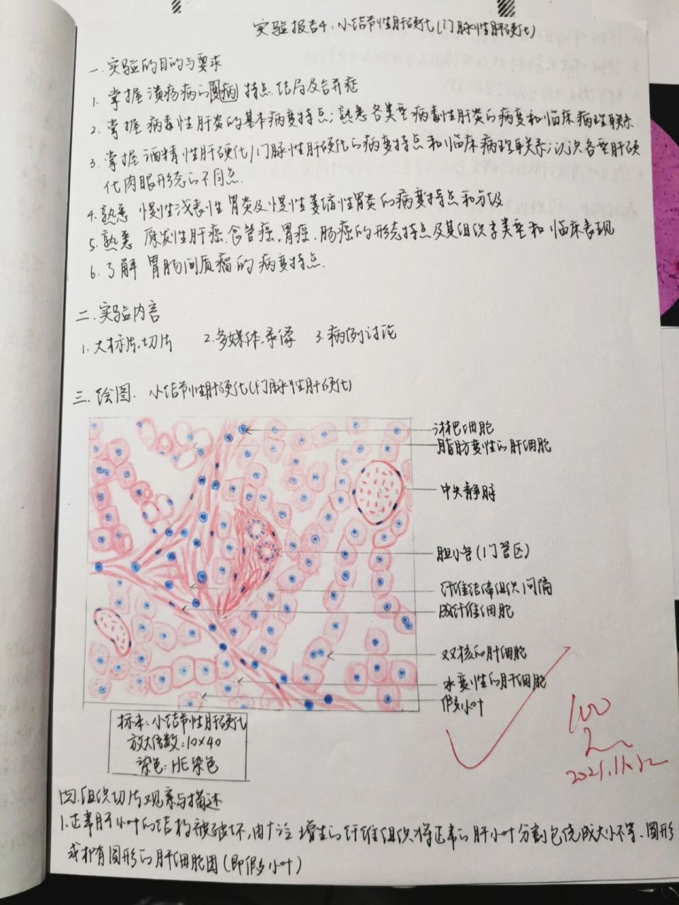 病理实验红蓝铅笔绘图4-小结节性肝硬化 好像是最后一次要画图的啦