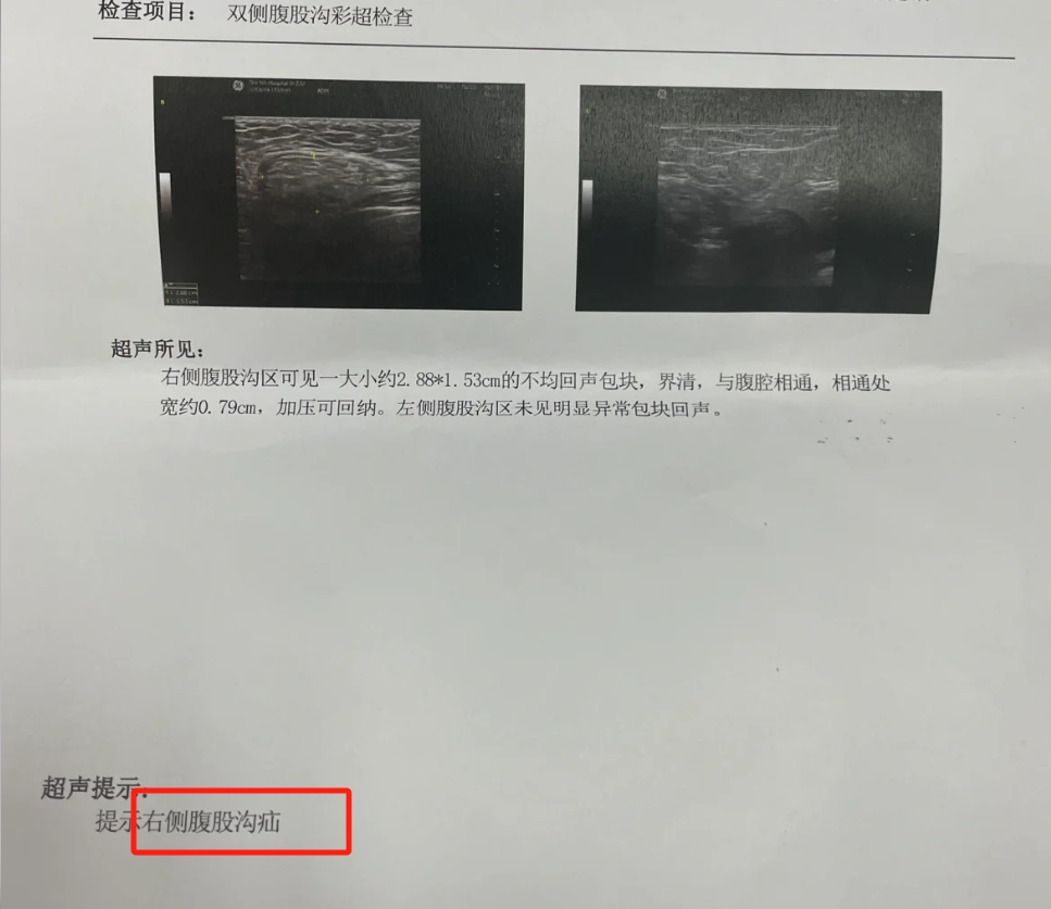 走路时右下腹隐隐作痛可能由多种原因引起,常见的有阑尾炎,肠炎,输