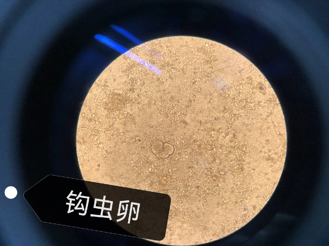 今天在镜下看到千年难遇的钩虫卵💩