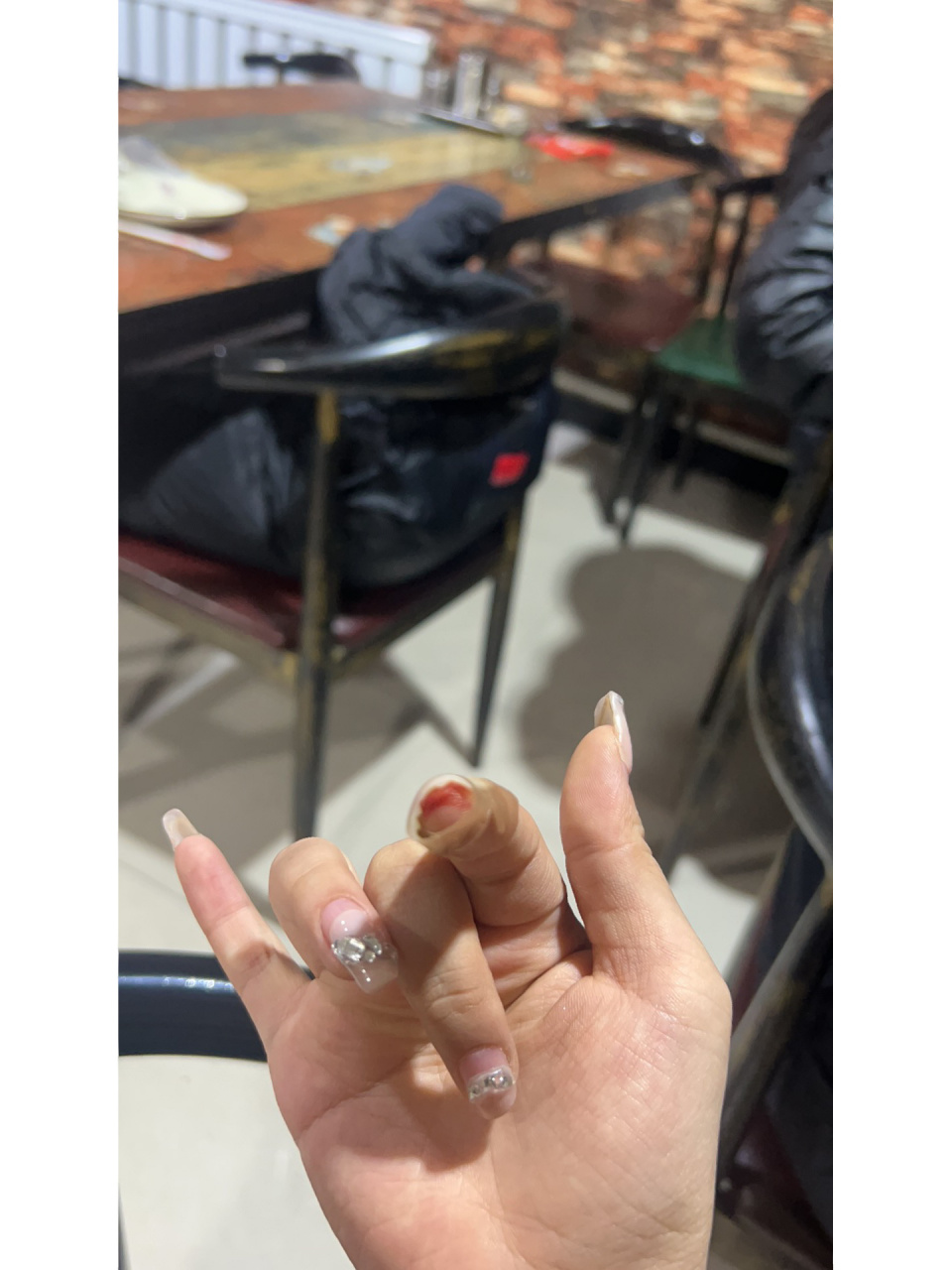 手指甲劈了怎么办!