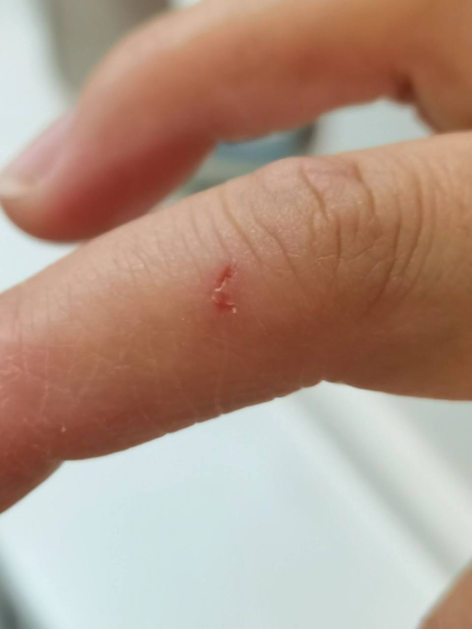 被两个月小奶狗牙齿刮伤了 需要打狂犬疫苗吗?