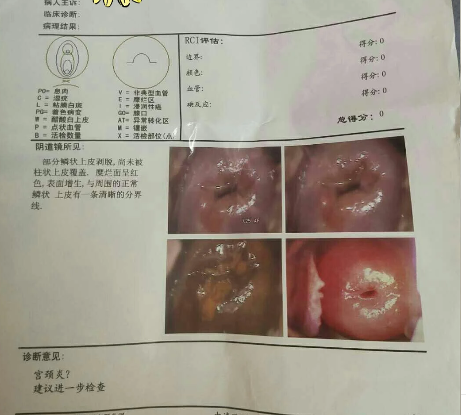 常见原因包括初潮不规律,阴道炎或宫颈炎等