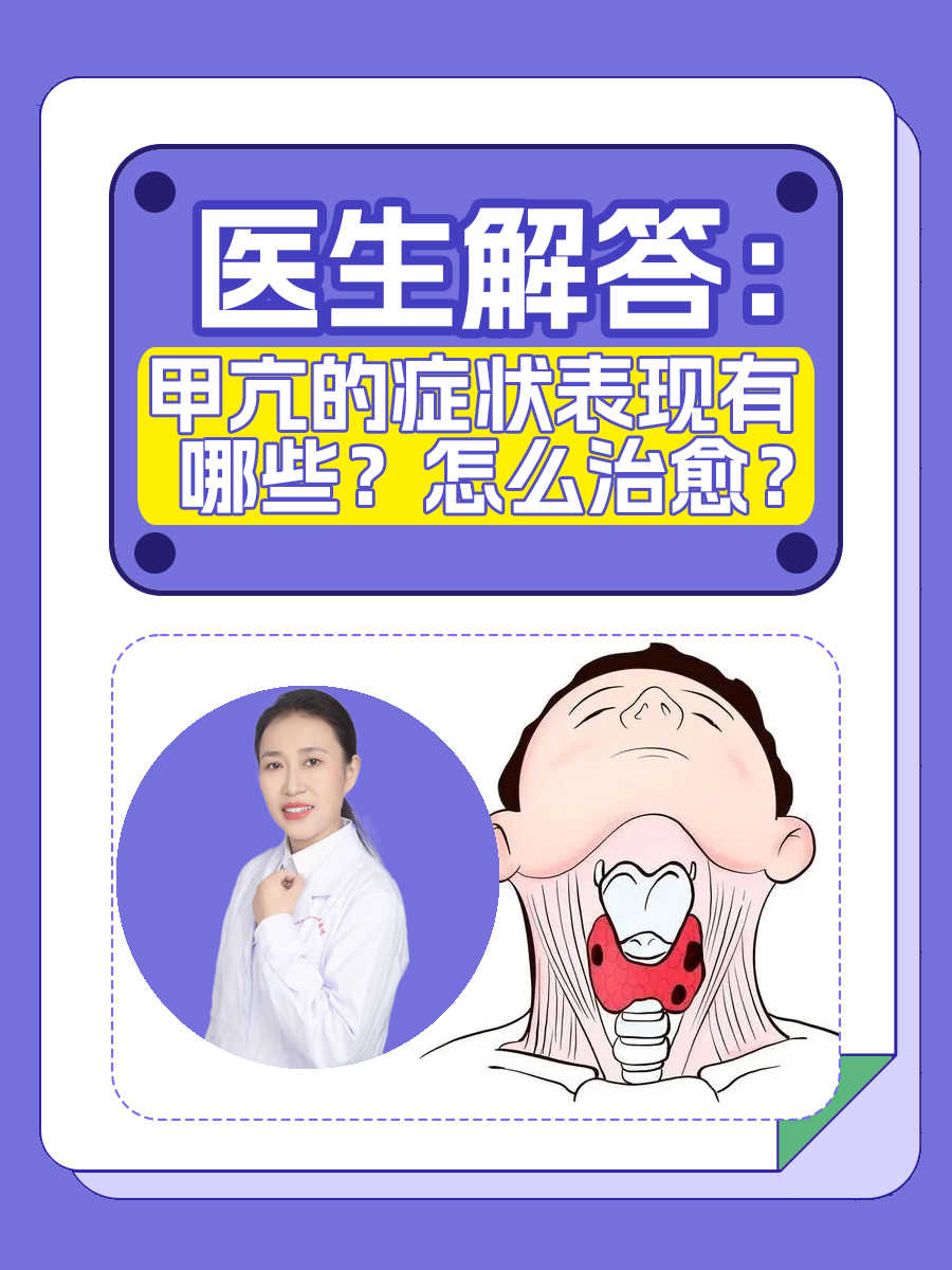 甲亢,即甲状腺功能亢进症,是一种由于甲状腺激素分泌过多而引起的内