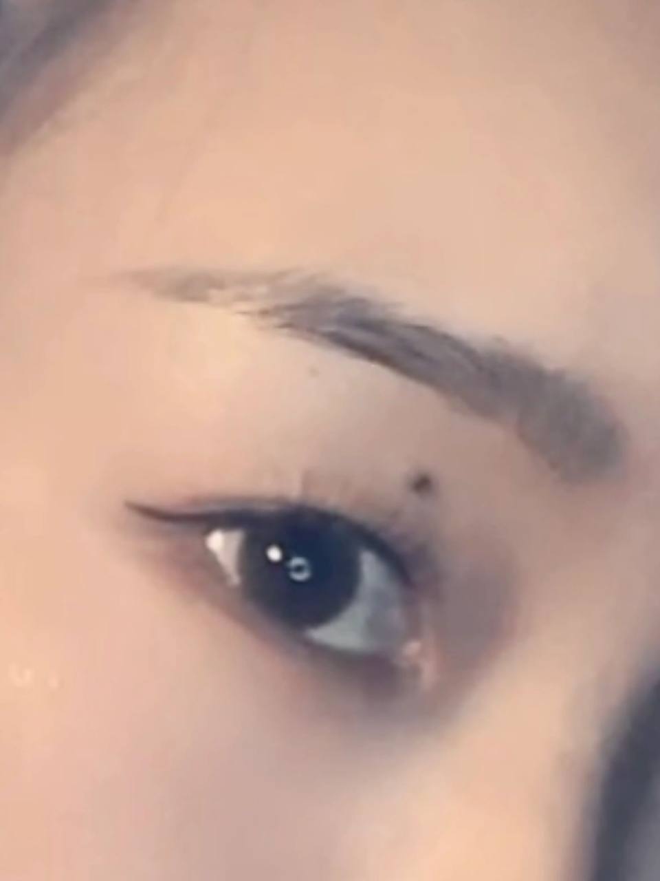 眼皮上长痣好吗 在犹豫要不要打掉 眼皮上长痣好吗 在犹豫要不要打掉