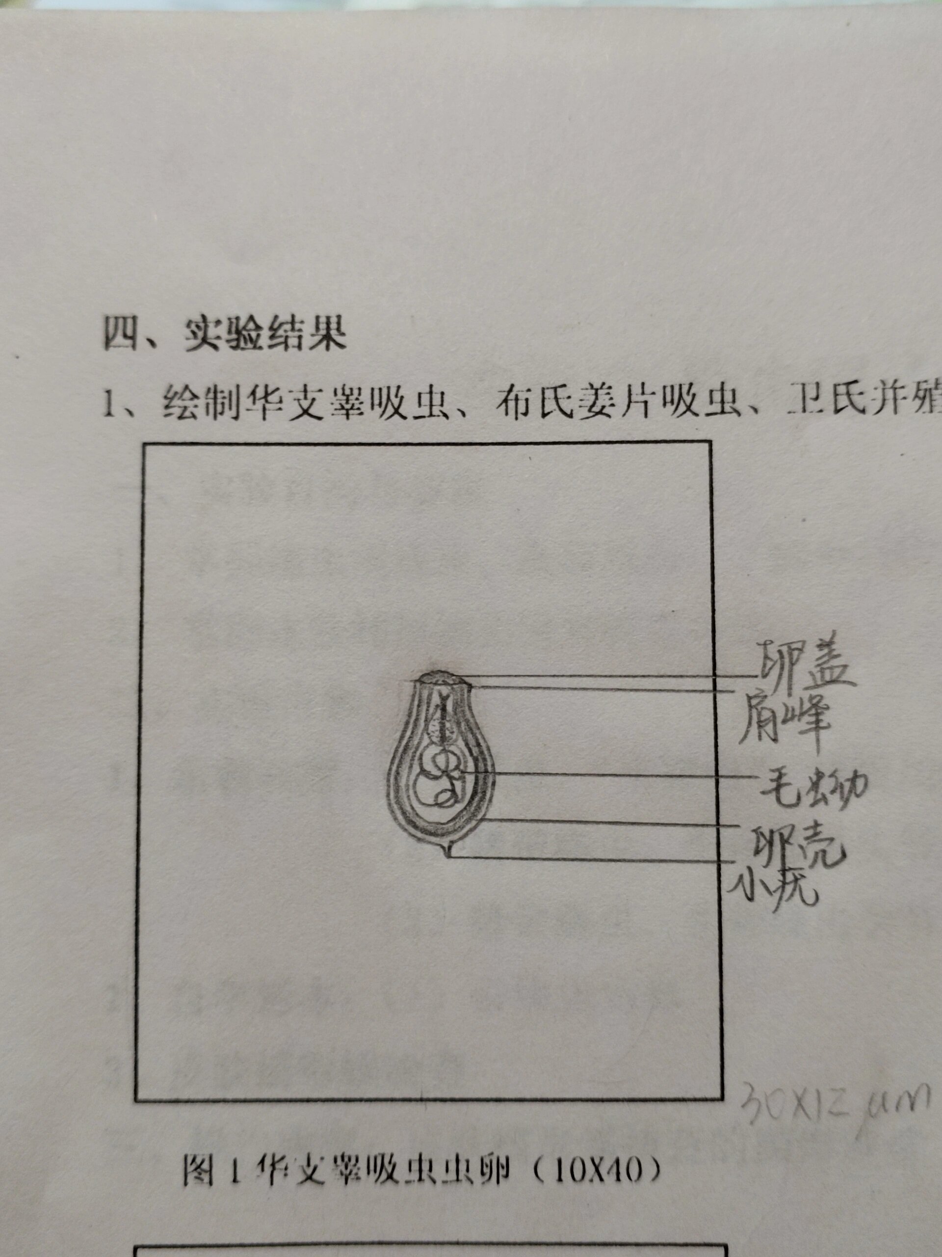 彩蚴吸虫 解剖图片