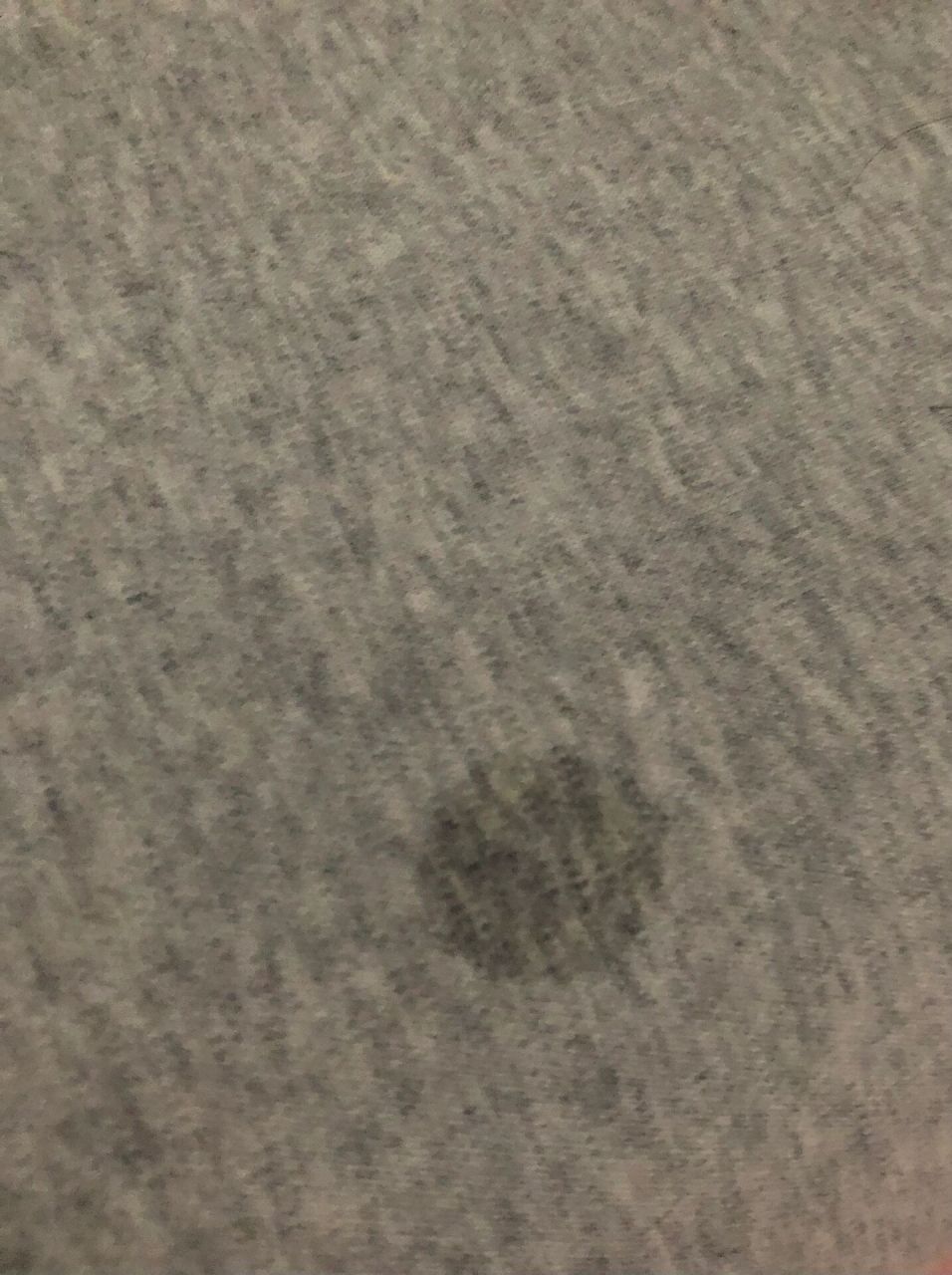 千万不要轻易用双氧水洗耳朵!