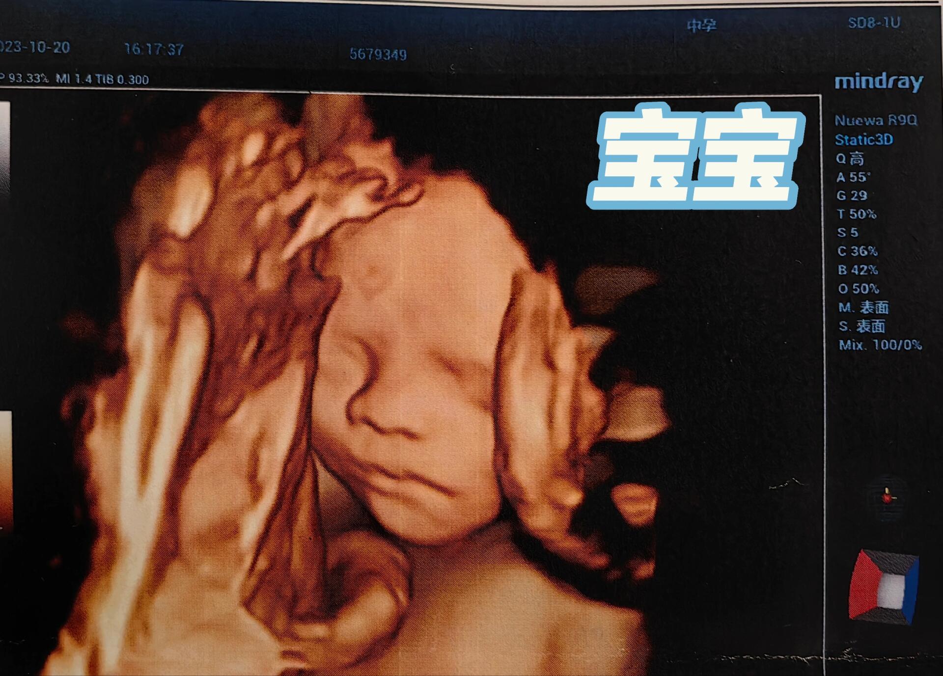 孕25w一身反骨宝宝三维照来啦