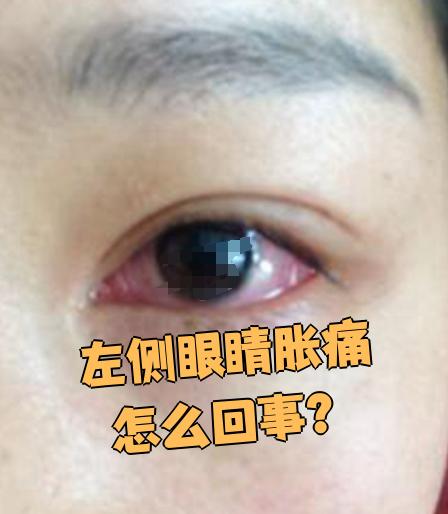 具体表现和处理方法如下: