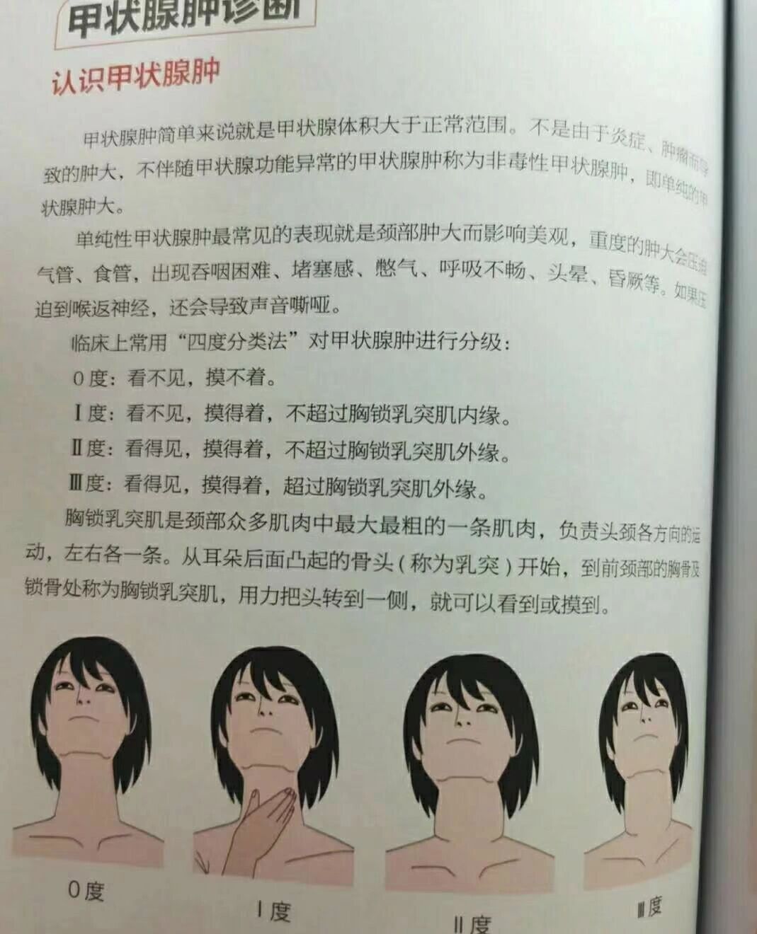 如何自查甲状腺 对于如何自查甲状腺疾病