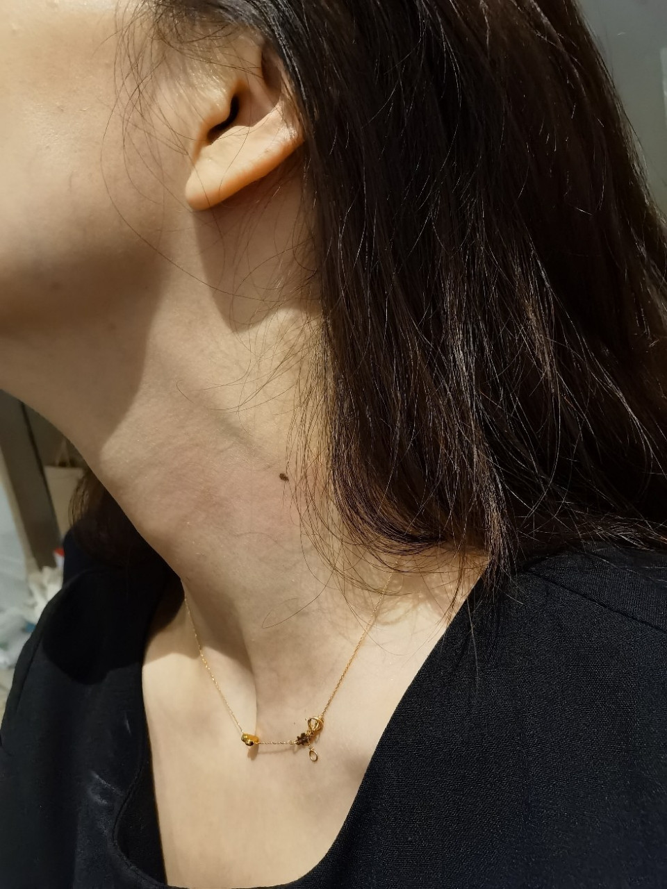 女人脖子左边的痣好吗 女人脖子左边的痣好吗