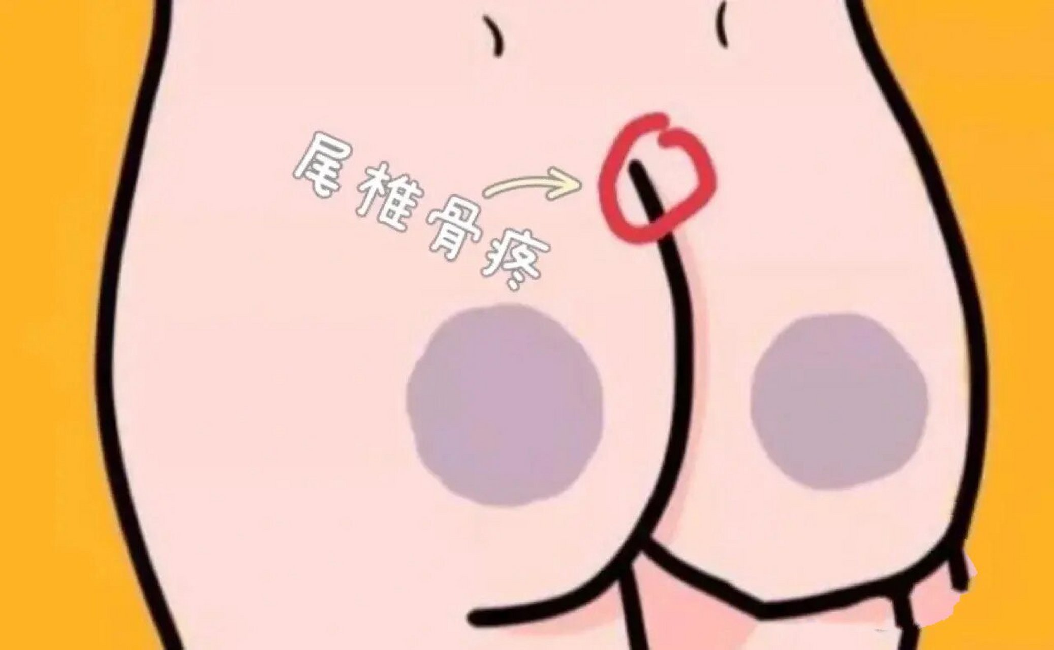 孕9周尾椎骨疼 我现在才孕9周,肚子都还没显怀,怎么就开始尾椎骨疼了