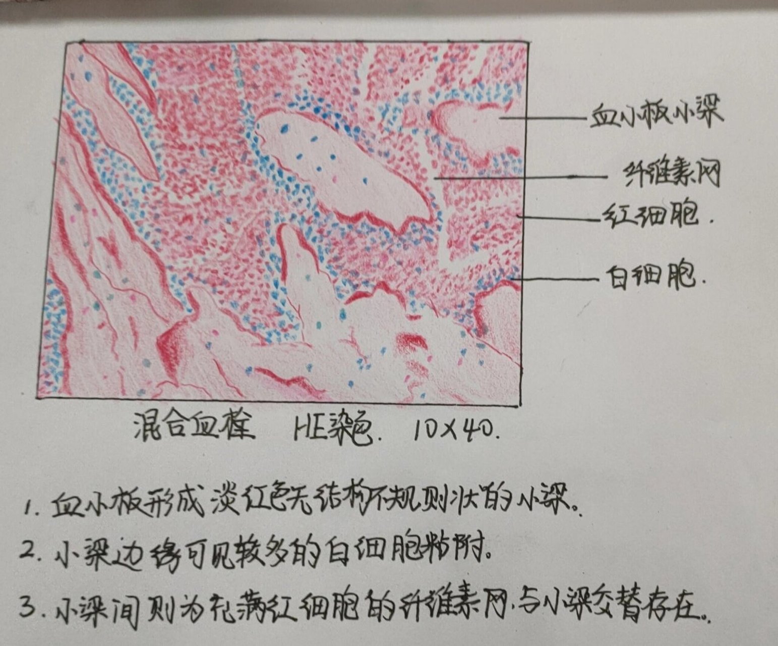 病理实验课_混合血栓 混合血栓红蓝铅笔绘图
