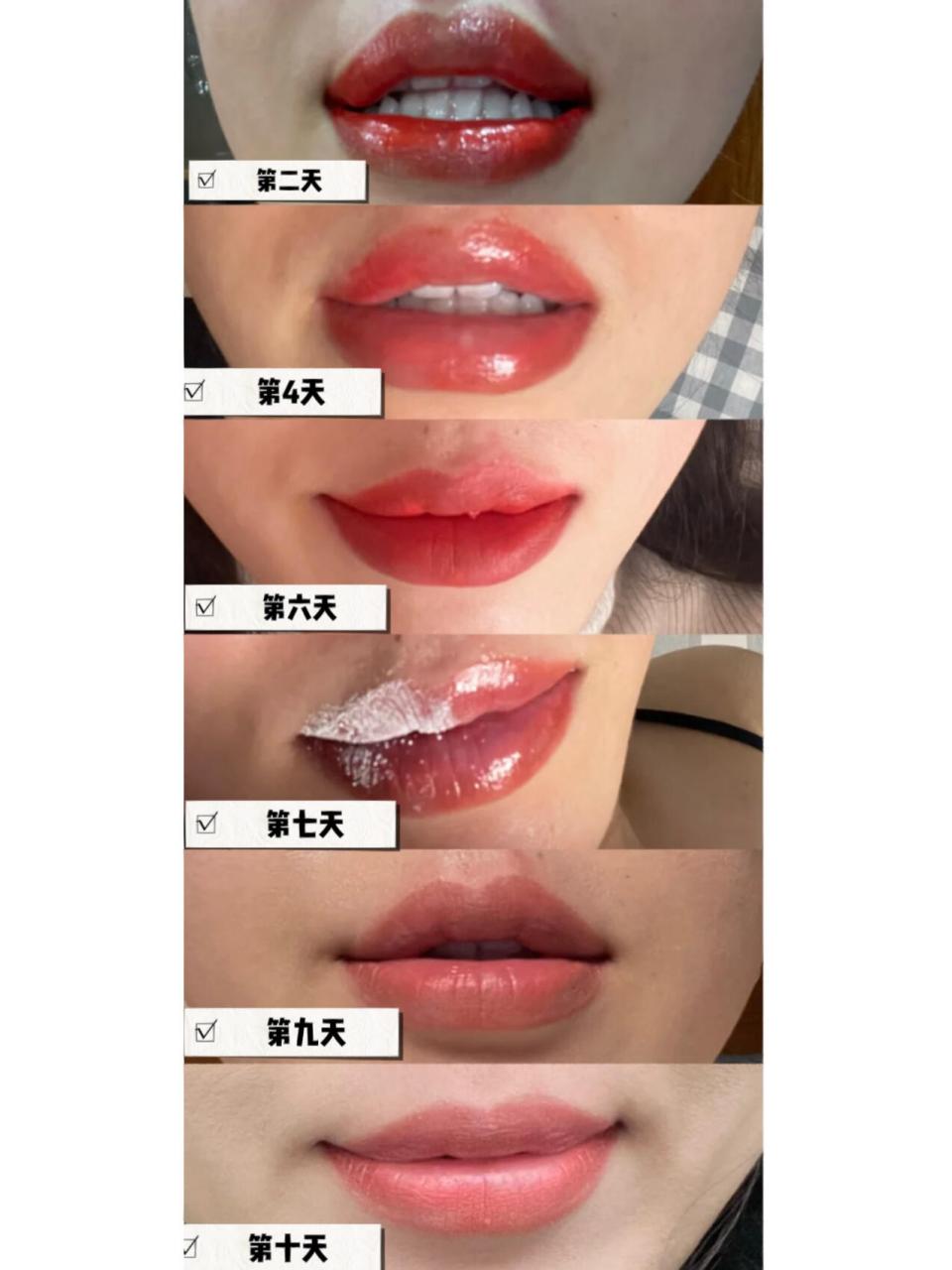 纹唇恢复全过程751560156015 纹唇恢复全过程,快看过来