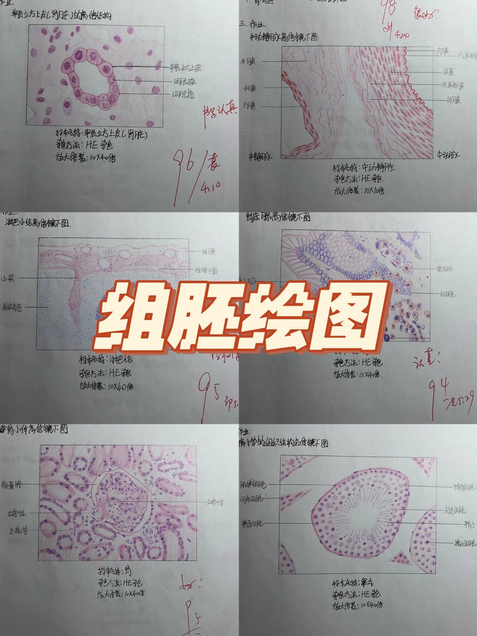 要结课了发一下,比较贴合实际不太算红蓝铅笔( p2 单层立方上皮 p3 中