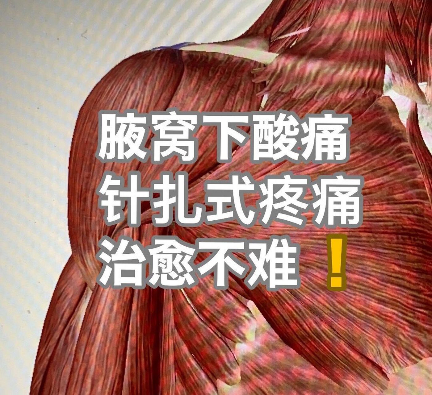 病例:这是一位在东京生活多年的老华侨,半年前开始腋窝下出现酸痛