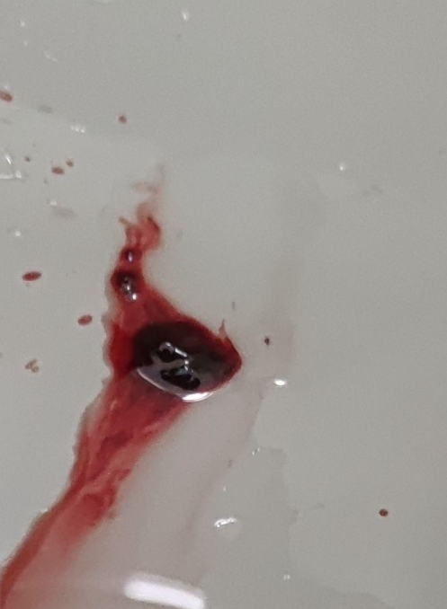 月经像一坨凝固的血块跟猪肝一样怎么回事?