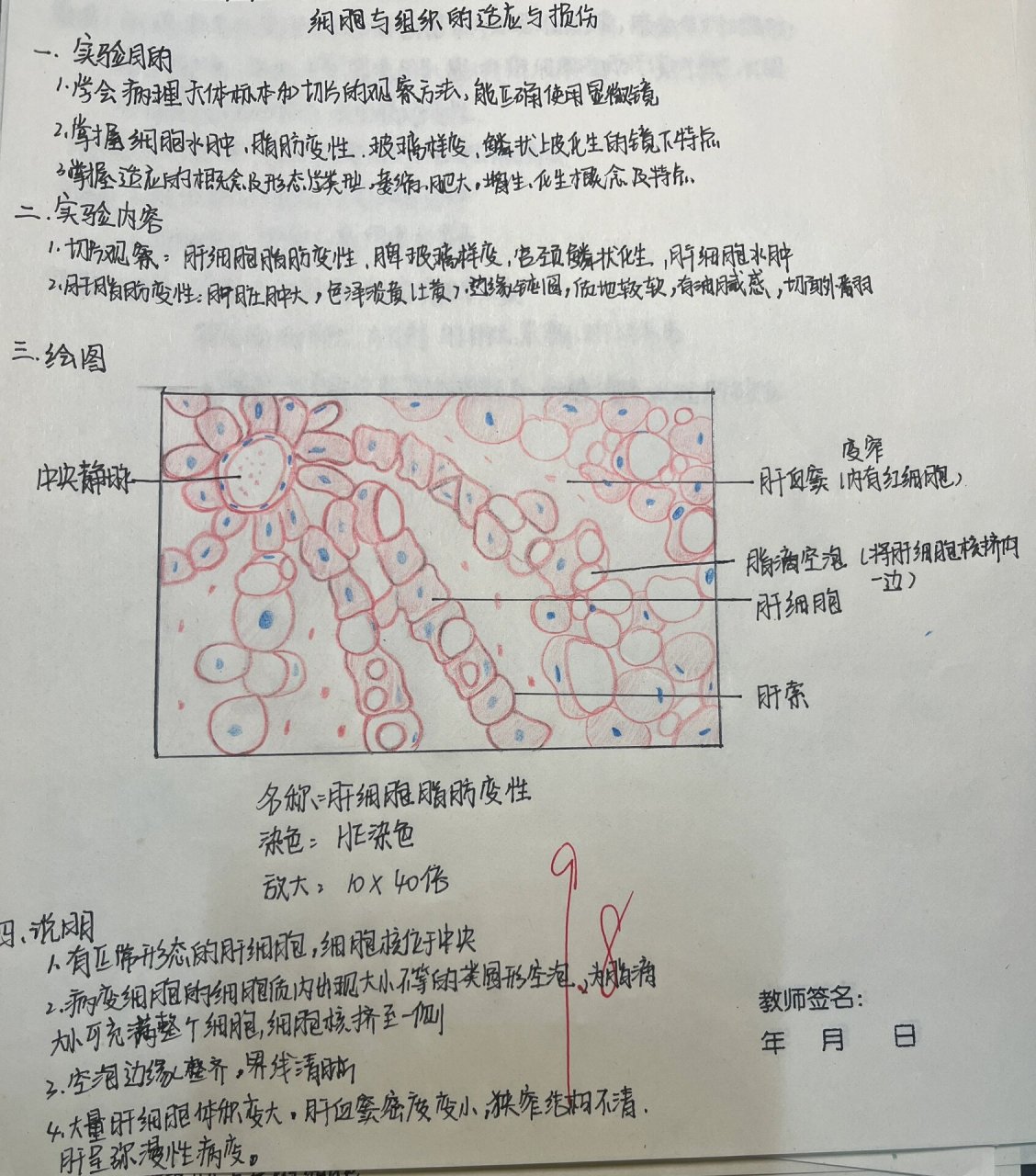 肝细胞脂肪变性(病理学实验报告) #红蓝铅笔绘图# #病理学实验报告