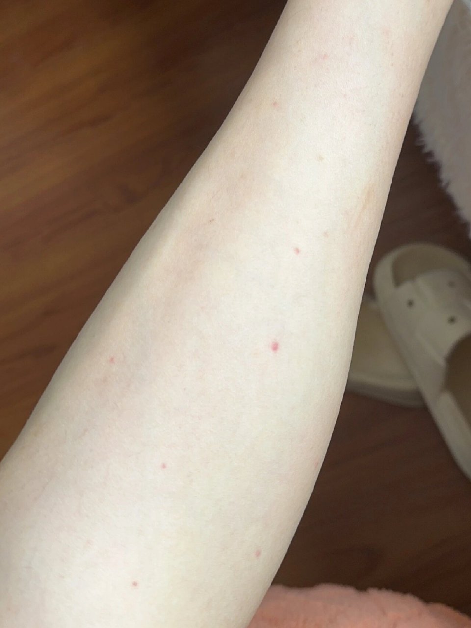 腿上长了许多不知名小红点 腿上长了好多不知名的小红点,不痛不痒.