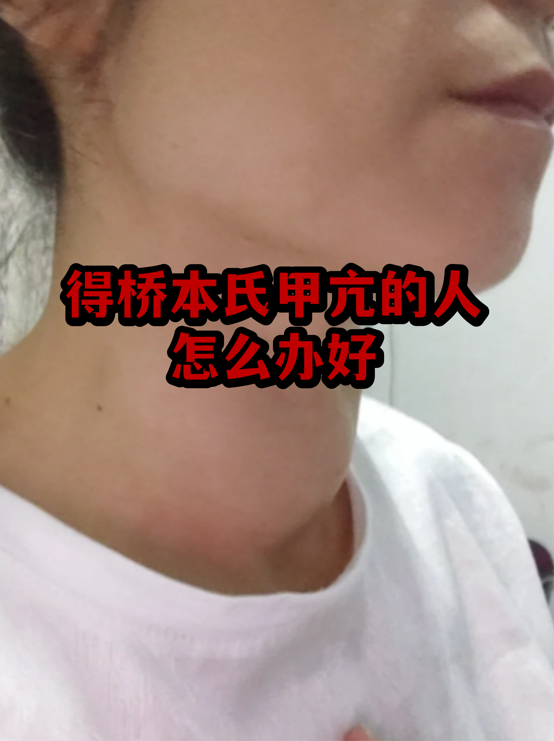  疫情的症状是什么样的(疫情的定义是什么)