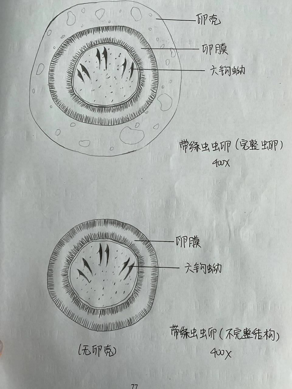 带绦虫虫卵手绘图      这次感觉画的不像,大家随便看看就行