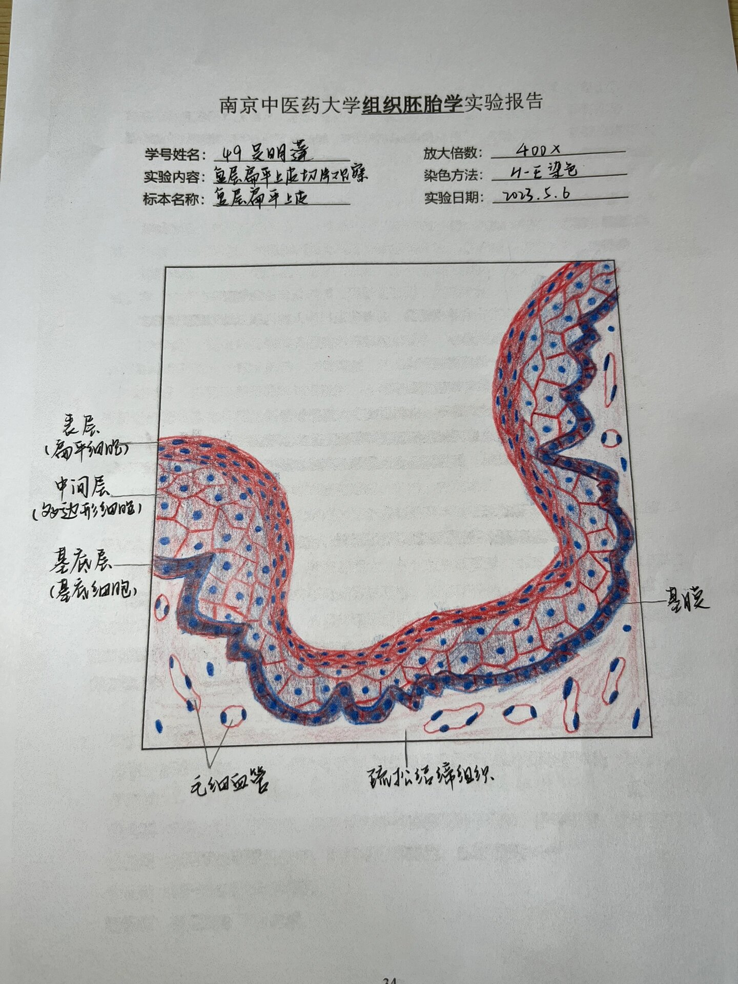 变移上皮40倍手绘图图片