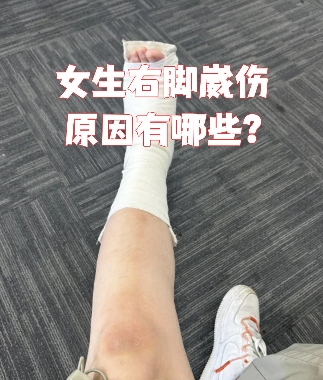 女生右脚崴伤通常是因为走路或跑步时没注意地面,或者突然踩空,用力