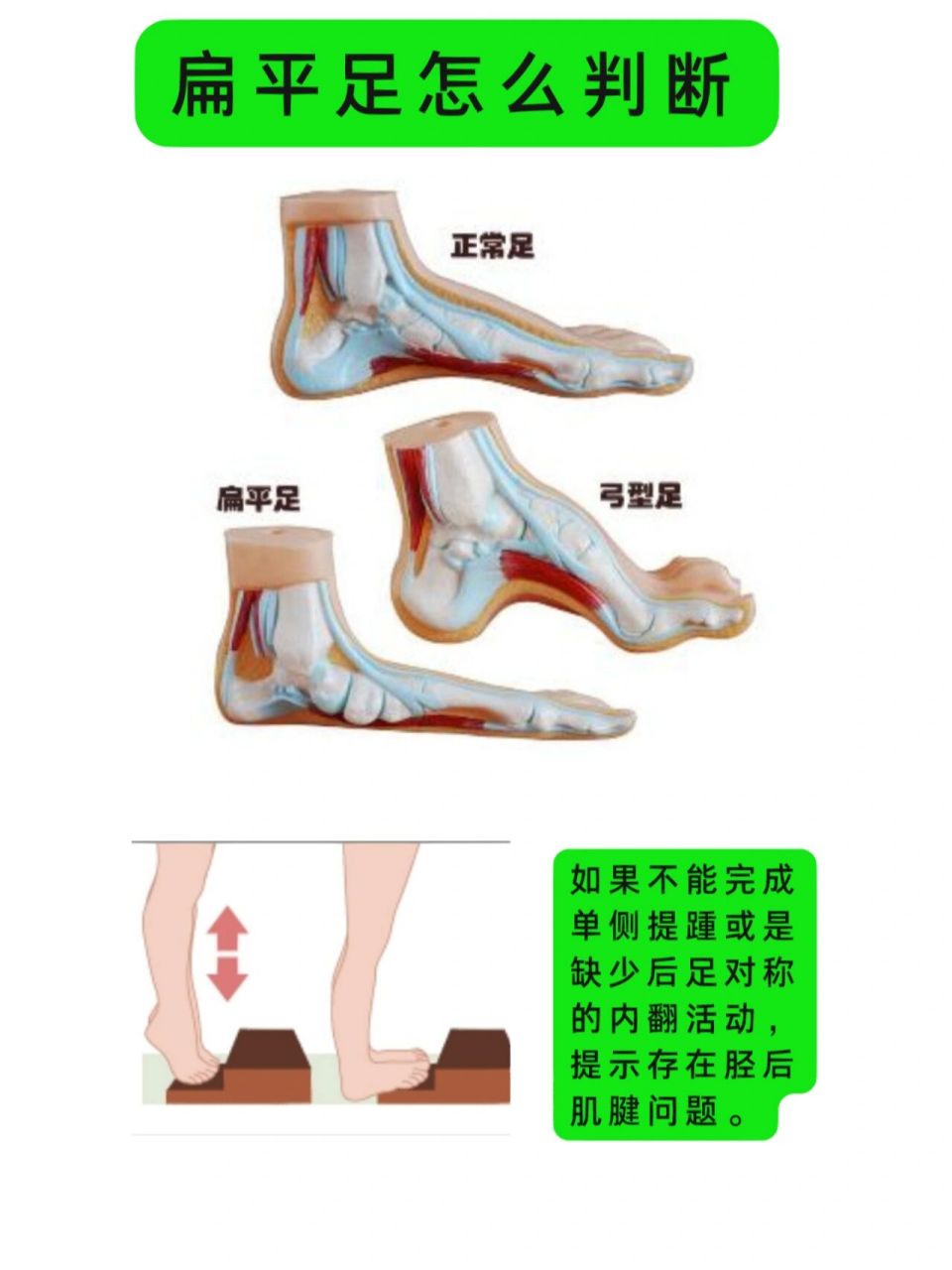 走路走多了脚后跟痛是什么原因?