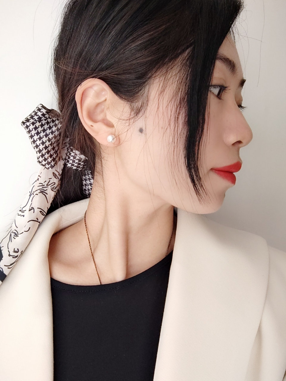 耳前痣要不要去掉 自从脱了鬓角毛发,耳前痣特别明显,有说耳前痣挡财