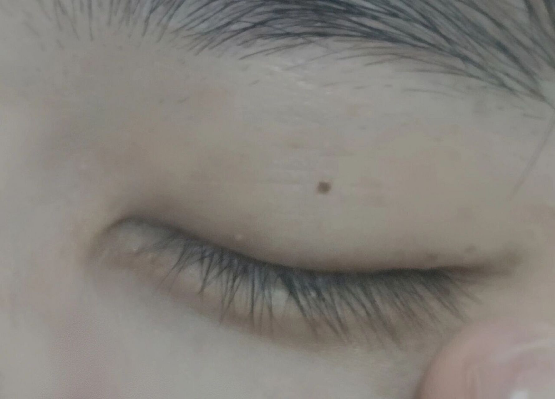 左眼上的痣,是什么意思呢02