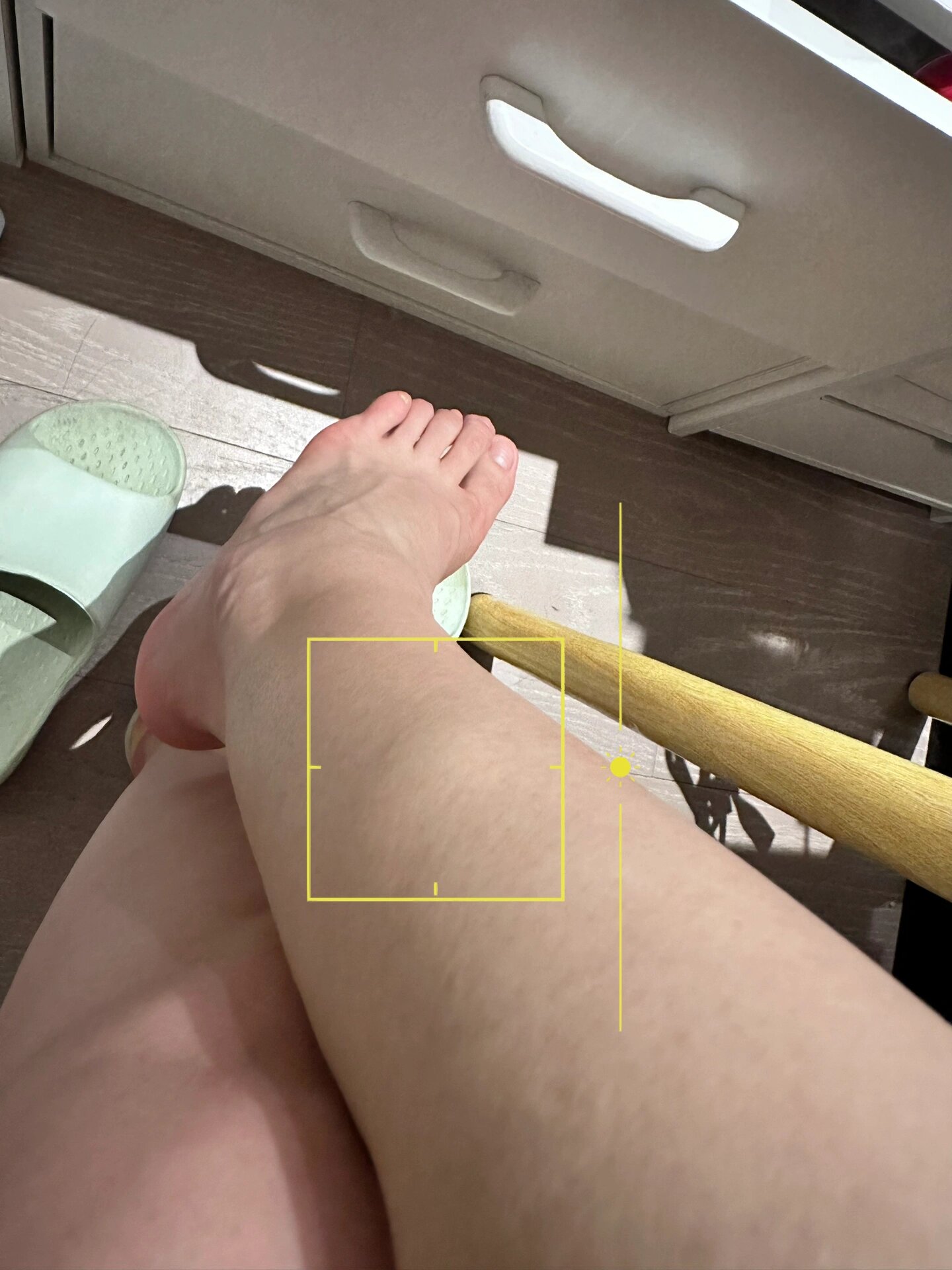 为什么我的小腿会有一块鼓起?