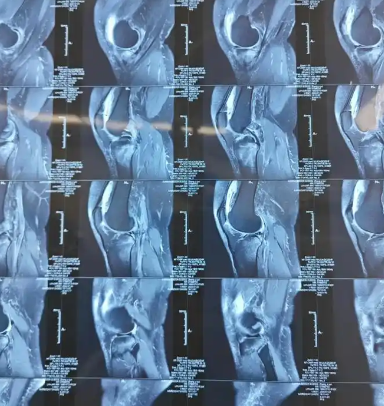 骨头为什么会响 骨头为什么会响