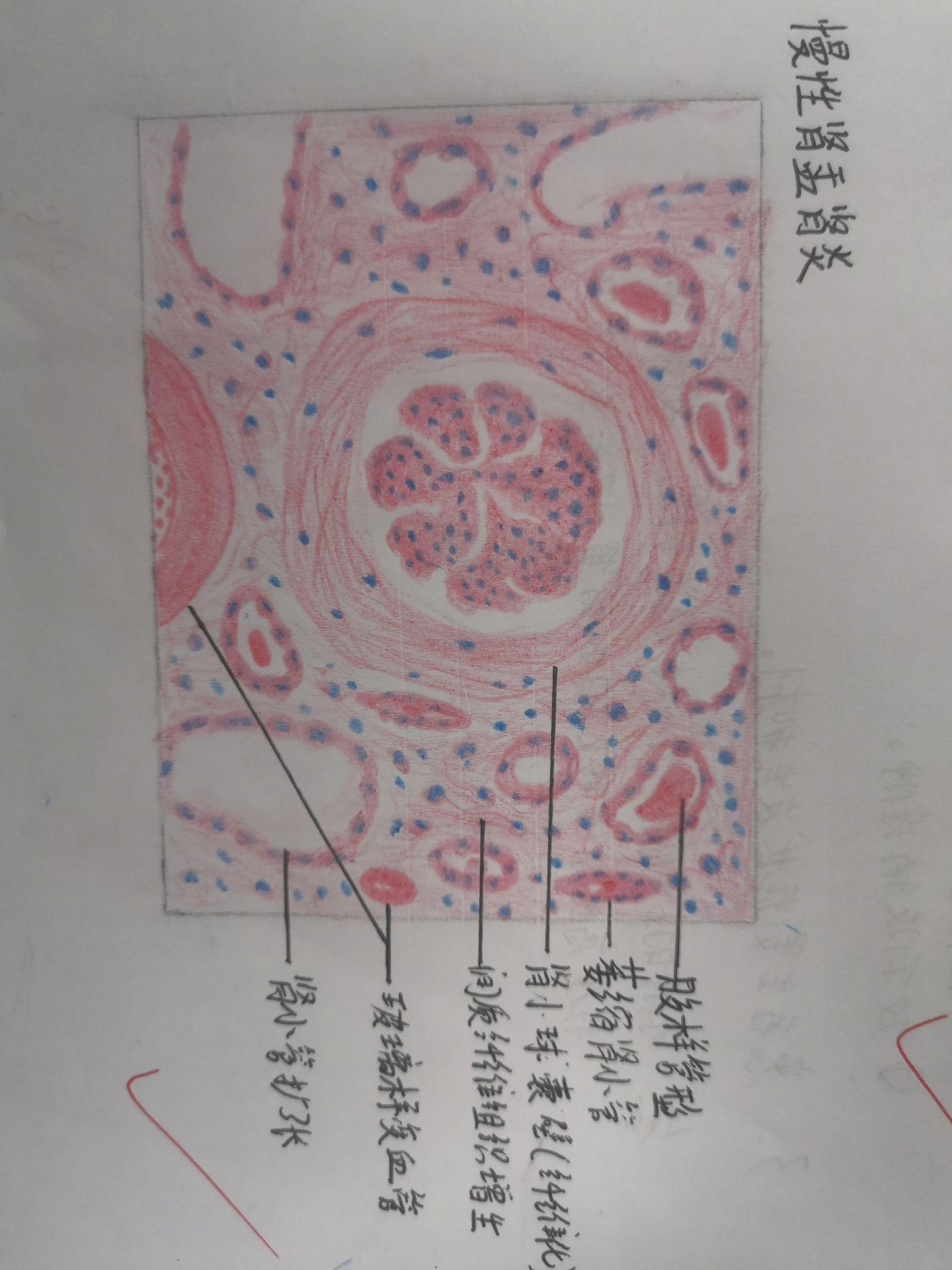 乙脑病理红蓝铅笔图图片