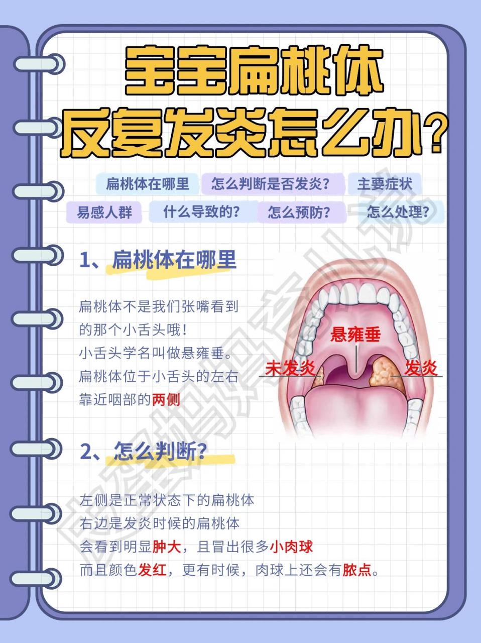 扁桃腺炎症图片