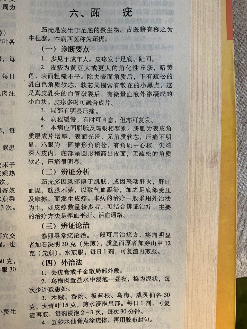 中医对跖疣的治疗,有的看过来 趾疣是发生于足底的赘生物