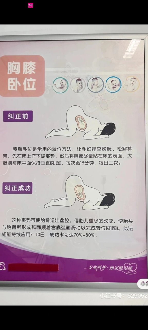 孕妇屈膝卧位姿势图片图片