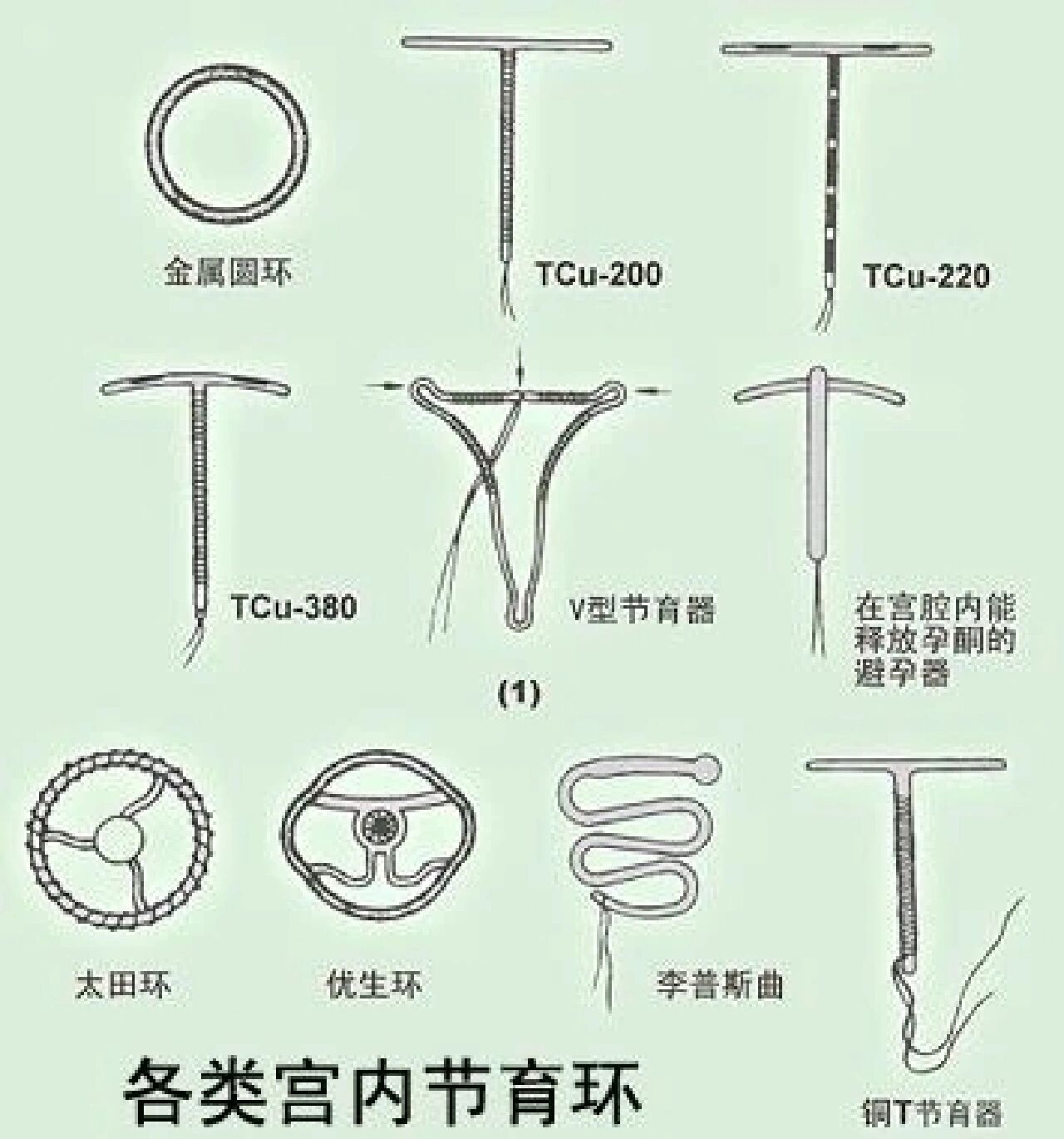 女性上节育环图片