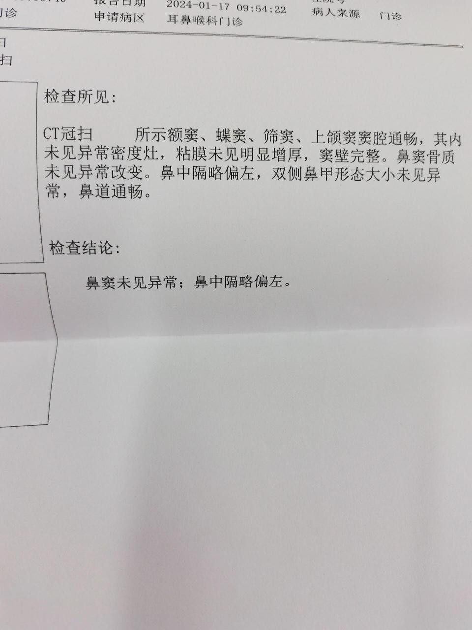鼻子ct 抠鼻子偶然摸到右侧鼻孔里有块硬硬的骨头样突起,左侧没有