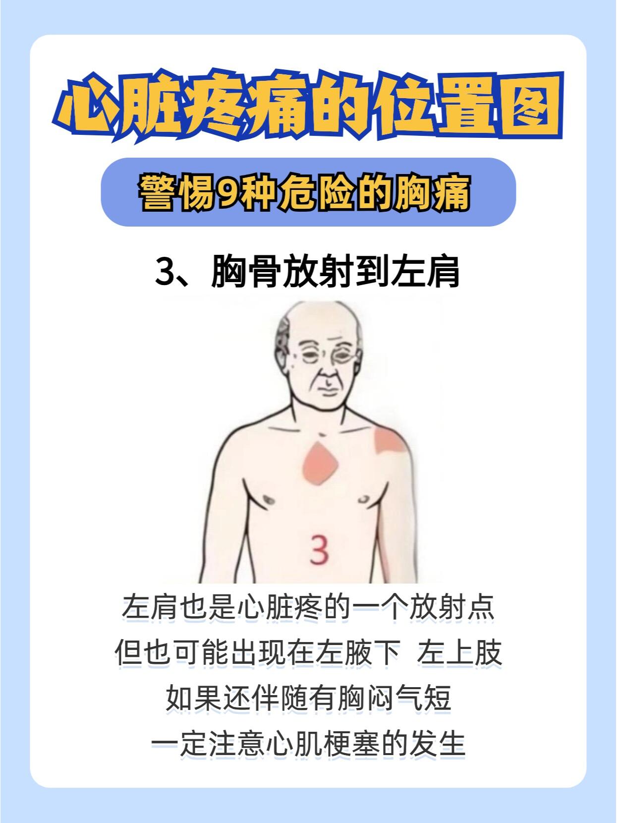 9种危险的 心脏疼痛位置图