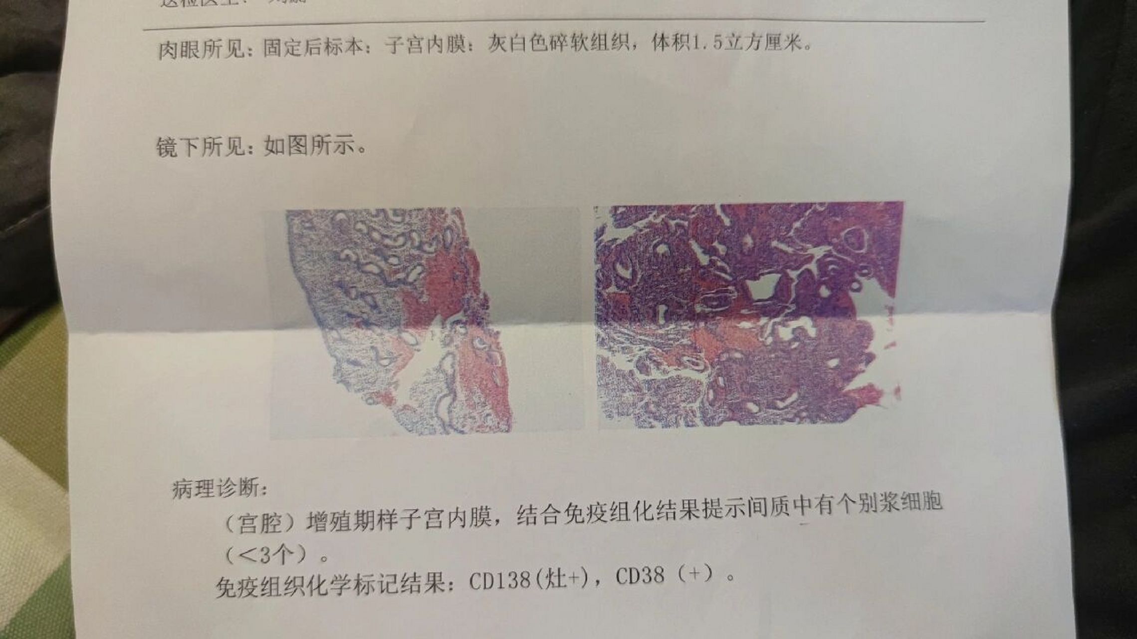 宫腔镜病理报告图片图片